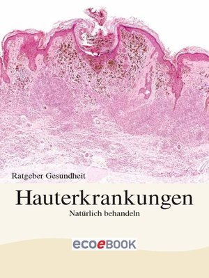 cover image of Hauterkrankungen--Natürlich behandeln